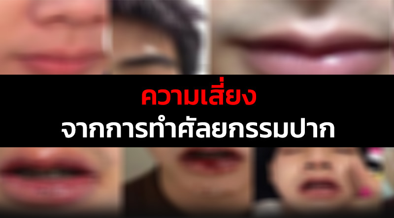 ศัลยกรรมปาก